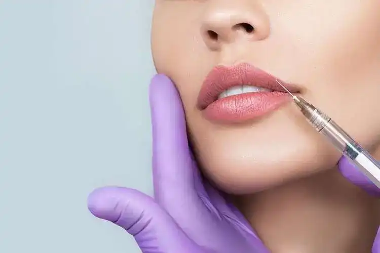 Lip Filler